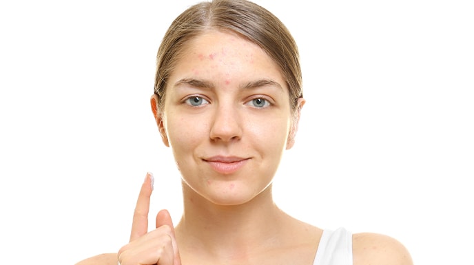 Creme e sieri anti acne